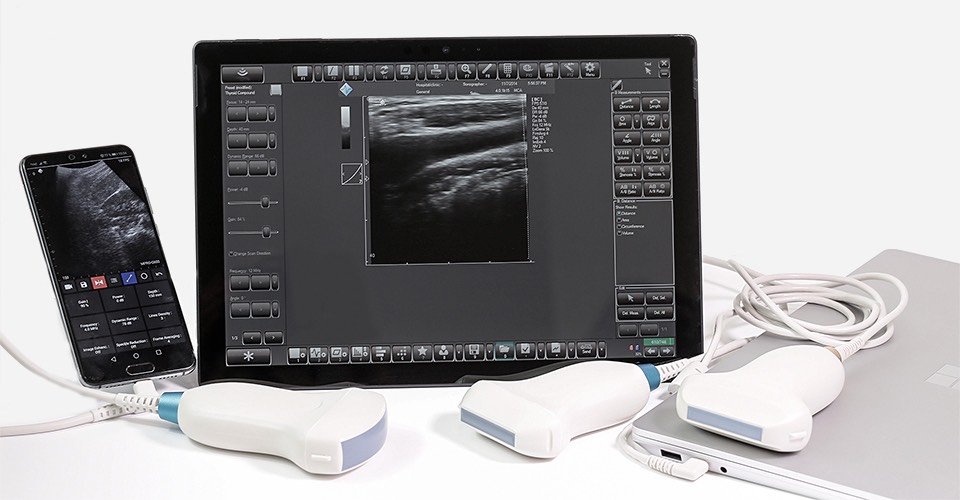 TELEMED ultrasound scanner connected to a laptop, tablet and smartphone