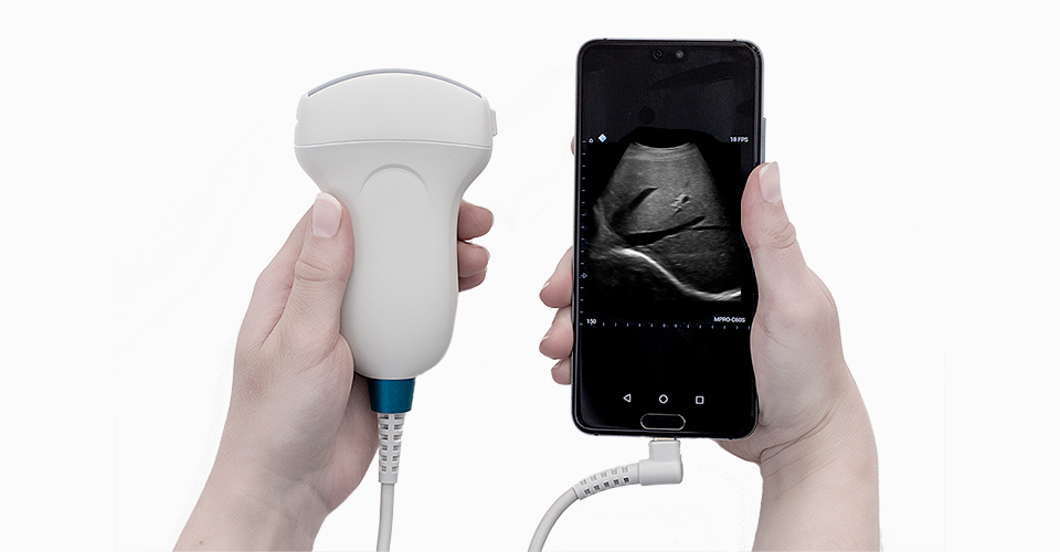 TELEMED USB ultrasound probe connected to a smartphone